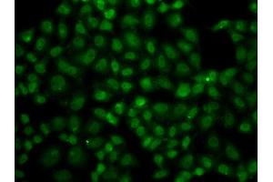 Immunofluorescence analysis of A549 cell using USP26 antibody. (USP26 antibody)