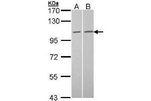 WB Image Sample (30 ug of whole cell lysate) A: A431 , B: Hela 7. (TUBGCP2 antibody  (N-Term))