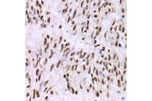 Immunohistochemistry (Paraffin-embedded Sections) (IHC (p)) image for anti-X-Ray Repair Complementing Defective Repair in Chinese Hamster Cells 6 (XRCC6) (AA 500-600) antibody (ABIN1513143)