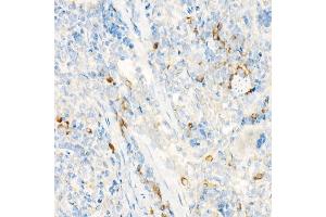Immunohistochemistry of paraffin-embedded rat spleen using IL27RA Rabbit pAb (ABIN6128083, ABIN6142374, ABIN6142375 and ABIN6224203) at dilution of 1:25 (40x lens). (IL27 Receptor alpha antibody  (AA 33-283))