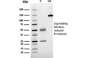 SDS-PAGE Analysis Purified PTH Mouse Recombinant Monoclonal Antibody (rPTH/911). (Recombinant PTH antibody  (AA 1-34))