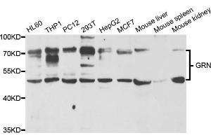 Western blot analysis of extracts of various cell lines, using GRN antibody. (Granulin antibody)