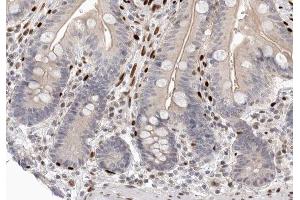 ABIN6266728 at 1/100 staining human colon tissue sections by IHC-P. (CDK2AP2 antibody  (C-Term))