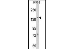 Western blot analysis of hAGL-C371 in K562 cell line lysates (35ug/lane)