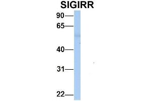 Host:  Rabbit  Target Name:  SIGIRR   Sample Type:  Human Adult Placenta  Antibody Dilution:  1. (SIGIRR antibody  (C-Term))