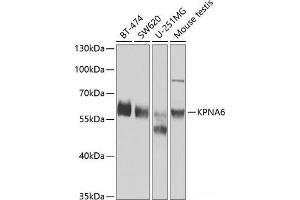 Western blot analysis of extracts of various cell lines using KPNA6 Polyclonal Antibody at dilution of 1:1000. (KPNA6 antibody)