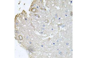Immunohistochemistry of paraffin-embedded rat brain using CHCHD3 antibody (ABIN5995784) at dilution of 1/100 (40x lens). (CHCHD3 antibody)