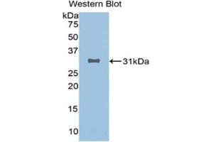 Detection of Recombinant SIRT3, Human using Monoclonal Antibody to Sirtuin 3 (SIRT3) (SIRT3 antibody  (AA 126-399))