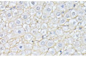 Immunohistochemistry of paraffin-embedded Rat liver using SPTAN1 Polyclonal Antibody at dilution of 1:100 (40x lens). (SPTAN1 antibody)