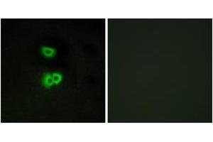 Immunofluorescence analysis of A549 cells, using GPR101 Antibody. (GPR101 antibody  (AA 245-294))