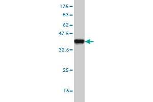 Western Blot detection against Immunogen (37. (DPYD antibody  (AA 1-110))