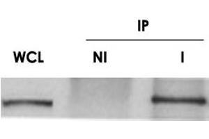 Western blot on human HeLa whole cell lysate (WCL) and ch-TOG immunoprecipitated (I) from mouse embryonic fibroblast whole cell lysate. (CKAP5 antibody)