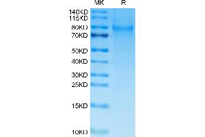 Human TIM-4 on Tris-Bis PAGE under reduced condition. (TIMD4 Protein (AA 25-314) (His tag))