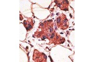 Image no. 2 for anti-Melanoma Antigen Family A, 9 (MAGEA9) (Middle Region) antibody (ABIN358651) (MAGEA9 antibody  (Middle Region))