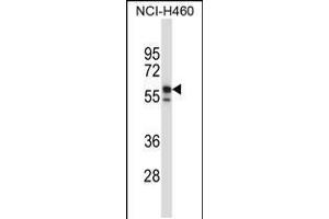 Western blot analysis in NCI-H460 cell line lysates (35ug/lane). (Keratin 6B antibody  (AA 207-236))