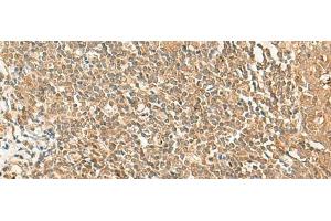 Immunohistochemistry of paraffin-embedded Human tonsil tissue using GRIPAP1 Polyclonal Antibody at dilution of 1:50(x200) (GRIPAP1 antibody)