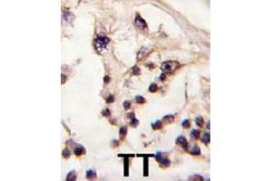 Formalin-fixed and paraffin-embedded human testis tissue reacted with TESK2 polyclonal antibody  , which was peroxidase-conjugated to the secondary antibody, followed by DAB staining. (TESK2 antibody  (Internal Region))