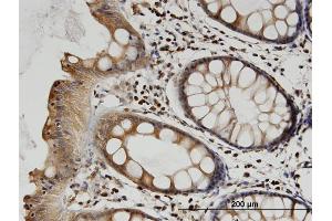 Immunoperoxidase of monoclonal antibody to TUBB2A on formalin-fixed paraffin-embedded human colon. (TUBB2A antibody  (AA 1-445))