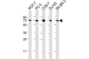 All lanes : Anti-USP2 Antibody at 1:2000 dilution Lane 1: MCF-7 whole cell lysate Lane 2: PC-3 whole cell lysate Lane 3: COS-7 whole cell lysate Lane 4: Du145 whole cell lysate Lane 5: SK-BR-3 whole cell lysate Lysates/proteins at 20 μg per lane. (USP2 antibody  (AA 1-258))