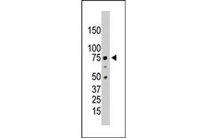 The PRMT5 polyclonal antibody  is used in Western blot to detect PRMT5 in HL-60 cell lysate.