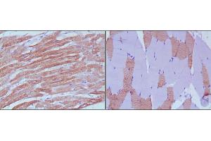 Immunohistochemical analysis of paraffin-embedded human skeletal muscle (left) and cardiac muscle (right) using MYL3 mouse mAb with DAB staining.