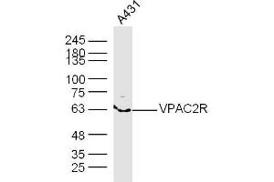 A431 lysates probed with VPAC2R Polyclonal Antibody, Unconjugated  at 1:300 dilution and 4˚C overnight incubation.