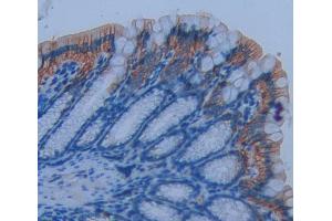 Used in DAB staining on fromalin fixed paraffin- embedded Kidney tissue (CD7 antibody  (AA 24-150))