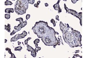 IHC analysis of RALBP1 using anti-RALBP1 antibody (ABIN5692936).