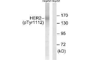 Western blot analysis of extracts from HepG2 cells, treated with PMA (125ng/ml, 20mins), using HER2 (Phospho-Tyr1112) antibody. (ErbB2/Her2 antibody  (pTyr1112))