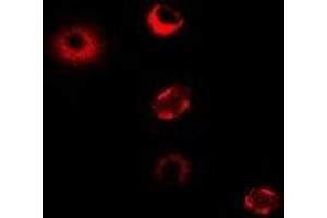 Immunofluorescent analysis of CPT1A staining in MCF7 cells. (CPT1A antibody)