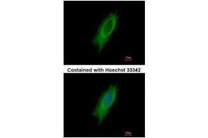 ICC/IF Image Immunofluorescence analysis of methanol-fixed HeLa, using HLA-DPA1, antibody at 1:500 dilution. (HLA-DPA1 antibody)