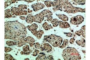 Immunohistochemical analysis of paraffin-embedded human-placenta, antibody was diluted at 1:200 (VEGFR2/CD309 antibody  (AA 1268-1341))