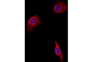 ABIN6257551 and ABIN6275682 staining HepG2 by IF/ICC. (WASF2 antibody  (Internal Region))