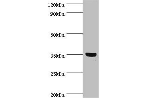 GLYATL1 Antikörper  (AA 1-302)