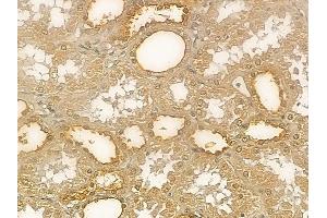 IDS Mouse Monoclonal Antibody at 1/100 staining human normal kidney tissue by IHC-P.
