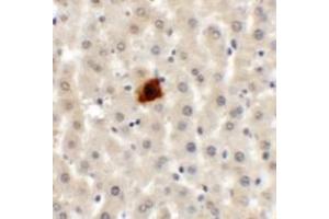 Immunohistochemistry of EI24 in rat liver tissue with EI24 antibody at 5 ug/mL. (EI24 antibody  (C-Term))