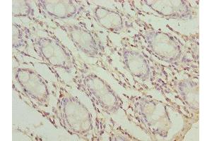 Immunohistochemistry of paraffin-embedded human colon tissue using ABIN7173261 at dilution of 1:100 (TMEM65 antibody  (AA 63-240))
