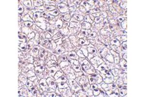 Immunohistochemistry of CRLF2 in human liver tissue with CRLF2 polyclonal antibody  at 5 ug/mL .