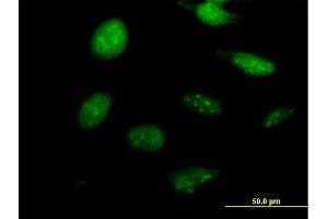 Immunofluorescence of purified MaxPab antibody to NKX2-8 on HeLa cell.