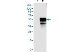 Western blot analysis of Lane 1: Negative control (vector only transfected HEK293T lysate), Lane 2: Over-expression Lysate (Co-expressed with a C-terminal myc-DDK tag (~3. (TEX9 antibody)