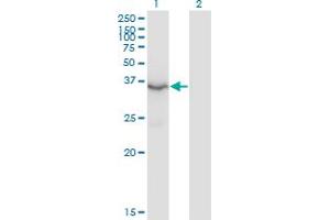 HSD3B2 antibody  (AA 33-122)