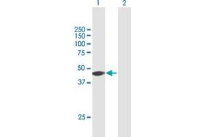 Western Blot analysis of ZNF385A expression in transfected 293T cell line by ZNF385A MaxPab polyclonal antibody.