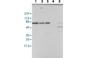 Western blot analysis of Lane 1: RT-4, Lane 2: EFO-21, Lane 3: A-431, Lane 4: Liver, Lane 5: Tonsil with RBM39 polyclonal antibody  at 1:100-1:250 dilution.
