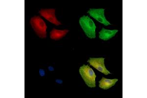 ABIN7096925 and ABIN7100991 staining  cells by IF/ICC. (CLN8 antibody)
