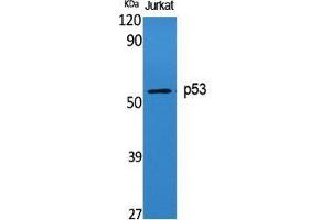 Western Blot (WB) analysis of specific cells using p53 Polyclonal Antibody. (p53 antibody  (Tyr191))