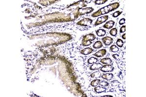 anti-Chromobox Homolog 8 (CBX8) (AA 1-389) antibody