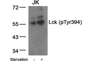 Western blot analysis of extracts from JK cells untreated or treated with starvation using Lck(Phospho-Tyr394) Antibody. (LCK antibody  (pTyr394))