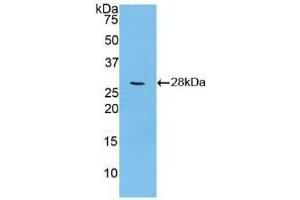 Detection of Recombinant CCND2, Human using Polyclonal Antibody to Cyclin D2 (CCND2) (Cyclin D2 antibody  (AA 68-278))