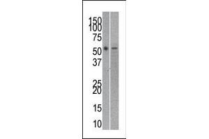 The anti-RUVBL21 Pab (ABIN388628 and ABIN2837871) is used in Western blot to detect RUVBL2 in mouse kidney (left) and SK-Br-3 (right) tissue/cell line lysates. (Reptin,TIP49B,RUVB2 (AA 400-430), (C-Term) antibody)