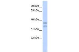 Image no. 1 for anti-Hydrolethalus Syndrome 1 (HYLS1) (AA 216-265) antibody (ABIN6743836) (HYLS1 antibody  (AA 216-265))